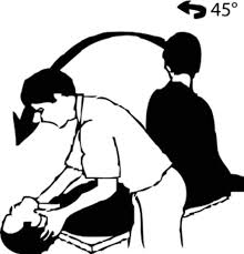 The canalith repositioning procedure for treatment of benign paroxysmal positional vertigo // otolaryngol head neck surg. Management Of Benign Paroxysmal Positional Vertigo Bmj Evidence Based Medicine
