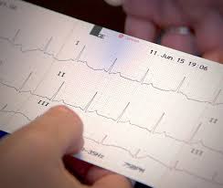 Ecg practice case study with interpretation by dr. Ecg Assessment And Interpretation Online Course