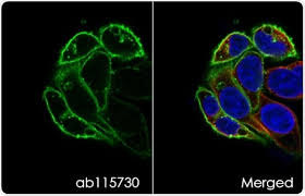 Image result for Hypoxis sp. A (as per FZ 12-3)
