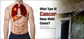 Cigarette smoking is by far the most common cause of lung cancer in the united states, but radon is the second leading cause. What Type Of Cancer Does Mold Cause