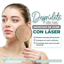 Eurolaser