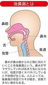 副鼻腔炎 蓄膿症 の対策 鼻水 鼻づまりも後鼻漏も頭痛も防ぐ ほお骨プッシュ カラダネ 副鼻腔 副鼻腔炎 鼻水