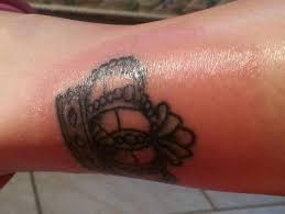 Both the long skin contact and the high concentrations of. Could There Be An Allergy To The Tattoo