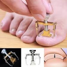 Shop the top 25 most popular 1 at the best prices! 10 Ingrown Toe Nail Ideas Ingrown Toe Nail Toe Nails Feet Care