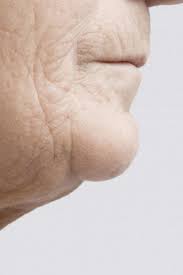 Find and get the latest cosmetics online. Jowls Exercises Causes Treatment And Prevention