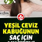 Yesil Ceviz Kabugunun Saca Faydalari Neler Nasil Uygulanir Dogal Tedavi Sac Yuz Konturlama Sac Dokulme Tedavileri