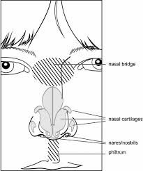 Elements Of Morphology Human Malformation Terminology