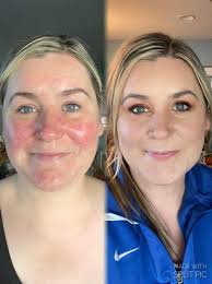 Artist Share! “It's the coverage of the #redness for me. Every. Single.  Time.” #testimonials #makeovermonday