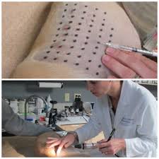 Examples of allergens include this series of allergy shots may help reduce your allergy symptoms. How To Stop Dog Allergies With Powerful Treatments That Work The Dog People By Rover Com