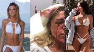 Duda Castro é acusada de quebrar garrafa em rosto de amiga de Biel – Metro  World News Brasil