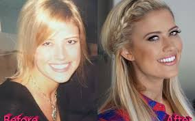 Christina anstead has become one of hgtv's most popular personalities, thanks to the success of hit renovation series flip or flop and christina on the. Christina Anstead Had Multiple Plastic Surgery Operations Learn Them All