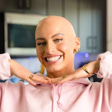 I Watched Myself Go Bald Three Times