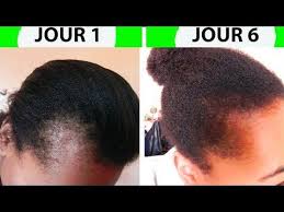 Je me posais une petite question me sa de bien pousse les cheveux par mois merci   et ya des produits. Edukacja Szkolna To Jest Tanie Spokojna Pousse Cheveux Par Jour Crisisresiliencesurvival Com