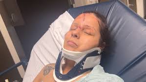 Fundraiser for Mayra Sandoval by Maricela Sandoval : Support Mayra's  Healing Journey and Recovery