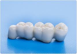 If you are someone that still enjoys hard and acidic foods, who may not brush every time they eat, or that may not floss every day, do not worry. Care For Dental Bridges