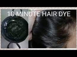 Pin On Hair Loss
