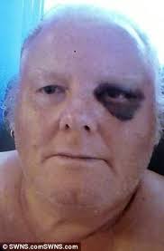 Elderly Bristol couple in fear after thug who put them in hospital moves in  3 doors away