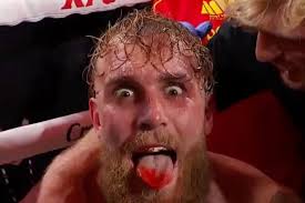 Excampeón Cristofer Rosales contra Abraham Medina este sábado en Managua