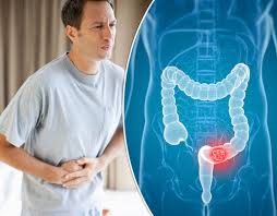 Every person over 50 should schedule a regular colonoscopy. Bowel Cancer Symptoms What A Healthy Stool Looks Like Express Co Uk