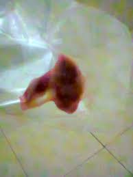 Kondisi tidak normal yaitu jika darah saat haid. Calon Janin Menstruasi Ibuhamil Com