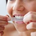 astuces pour des dents plus blanches - Le Figaro