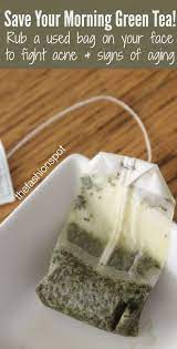21 Beauty Tips And Hacks That Actually Work Thefashionspot Baking Soda Shampoo Brown Spots On Skin Brown Spots On Face