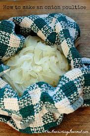7 onion home remedies you can count on+−. How To Make An Onion Poultice The Nourishing Gourmet