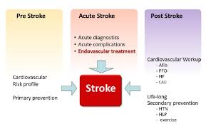 Image result for CVA Management