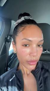 Attiva Skin Treatment in Vegas