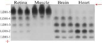 Native Gel Electrophoresis Of Ldh Isoenzymes In Control Mouse Tissues Download Scientific Diagram