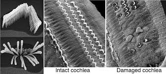 Think of the sound wave as a drumstick. As Many Exceptions As Rules An Immovable Moving Part That S Just Cilia Hearing Health Ear Inner Ear