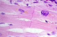 Stock fotografie Srdeční Myocyty Lipofuscin – stáhnout ...