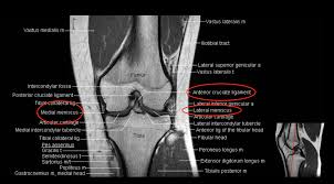 And the medial and lateral tibiofemoral articulations linking the femur, or thigh bone, with the tibia, the main bone of the lower leg. A Radiologist S Exploration Of The Stanford Ml Group S Mrnet Data By Walter Wiggins Towards Data Science
