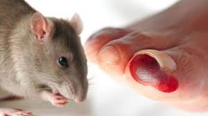 Tikus dapat masuk dari celah rumah tanpa kita sadari. Cara Menghindari Penyakit Leptospirosis Akibat Kencing Tikus Saat Musim Banjir Kenali Gejalanya Tribun Jatim