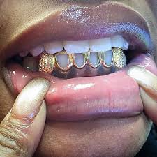 Permanent gold teeth are proper gold teeth this statement in itself is a confusing statement on its now that grillz are in place it eliminates the need for you to destroy your teeth just to have gold teeth. 10 Permanent Gold Teeth Ideas In 2021 Gold Teeth Teeth Girl Grillz