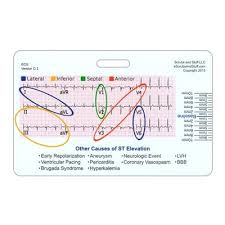 12 Lead Stemi Tool W Corresponding Vessels Chart Horizontal