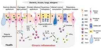 Image result for Drug-Induced Olfactory Dysfunction