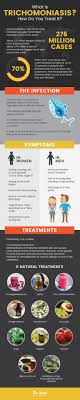 Trichomoniasis Symptoms Natural Treatments Dr Axe Natural Treatments Natural Remedies For Migraines Natural Eczema Remedies