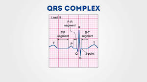 Understanding An Ecg Geeky Medics