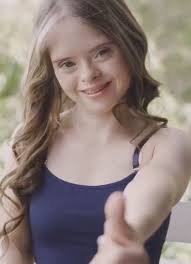 Model With Down Syndrome Feels...