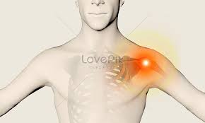 Semua ketidaknormalan pada kulit, jaringan lunak nyeri yang menyebar di bahu seperti ada beban dan tekanan di daerah bahu dan dada. Lengan Bahu Sakit Bahu Kiri Gambar Unduh Gratis Kreatif 400086998 Format Gambar Psd Lovepik Com