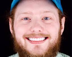 Order your smile my for today and tomorrow N$200 0814938040