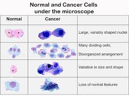 Overall, cancer personality is a great friend to anyone who is willing to be a friend in return. Characteristics Of Cancer Cells By Openstax Jobilize