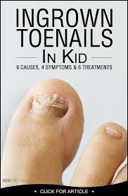 Pin On Foot Care Tips