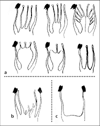 Image result for Brexia