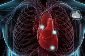 Eriksen sarà operato al cuore per l'inserimento di un defibrillatore cardiaco nei prossimi giorni. Defibrillatore Impiantabile Un Salvavita Sempre Al Tuo Fianco
