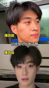 How to Fix a Bowl Cut? Male Fashion and Hairstyle Tutorial