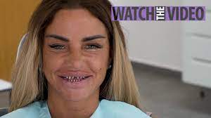 Katrina amy alexandra alexis price (née infield; Katie Price Spits Out Her Fake Teeth After They Fall Off Her Bond Villain Stumps As She Gets Veneers Replaced