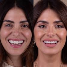 Aly Sanchez Oficial added a new...