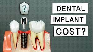 However, related costs or replacing multiple missing teeth with implants can drive your total cost up to as much as $29,500. How Much Do Dental Implants Cost Youtube